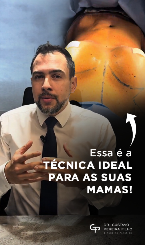 mama-mg-